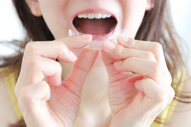 歯並びの治療はマウスピース矯正がおすすめ｜メリットやデメリット・注意点も詳しく解説