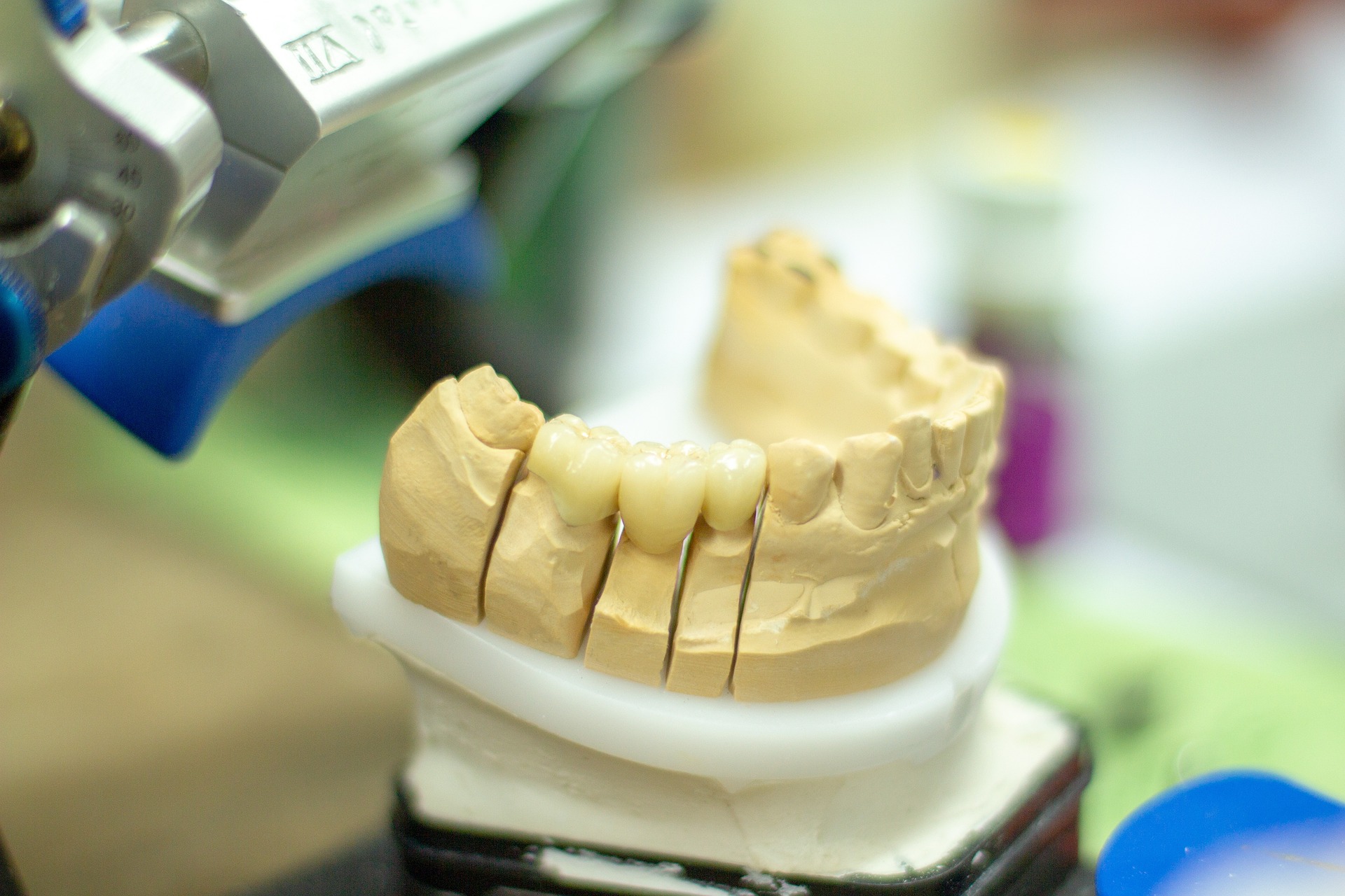 歯科矯正専門医の役割と重要性
