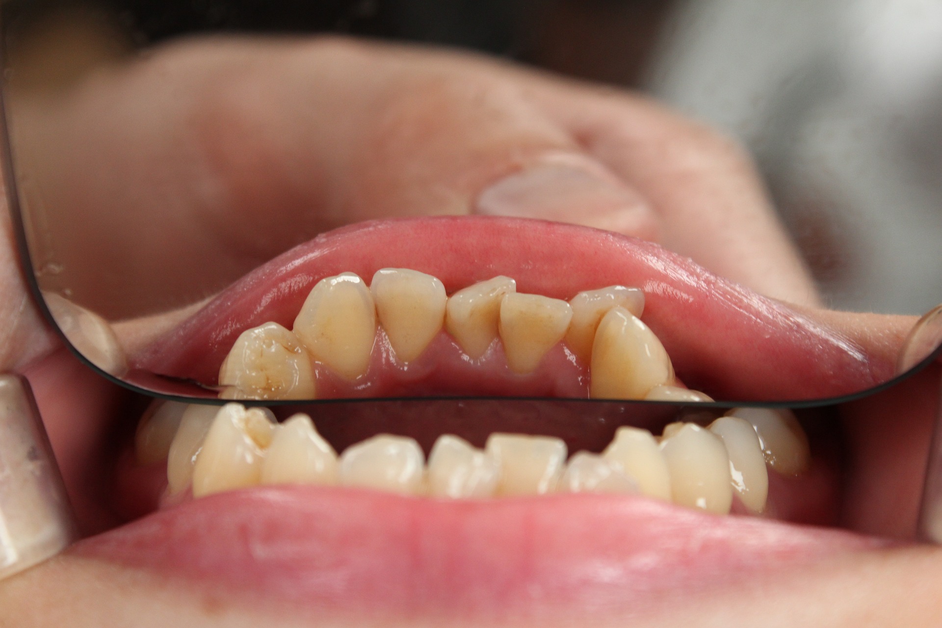 歯科矯正で得られる変化