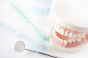 歯科矯正費用の節約術
