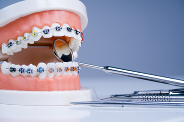 顎の歪みと歯列矯正の関係