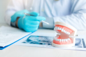 歯科矯正中の虫歯治療
