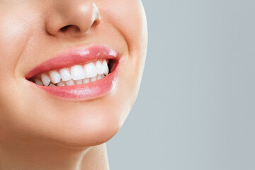 歯科矯正での口元の変化