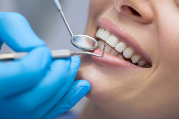 歯槽骨が薄い場合の歯科矯正治療