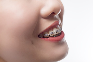 歯科矯正治療の通院頻度と期間

