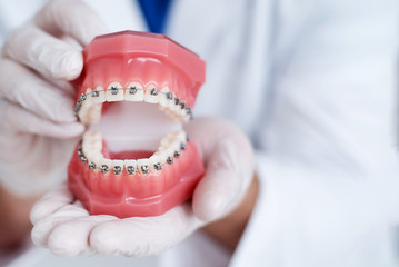 大人の歯列矯正治療