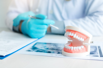 歯科矯正治療におけるリテーナーの種類