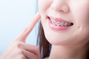 歯科矯正で顔の変化が現れる部分