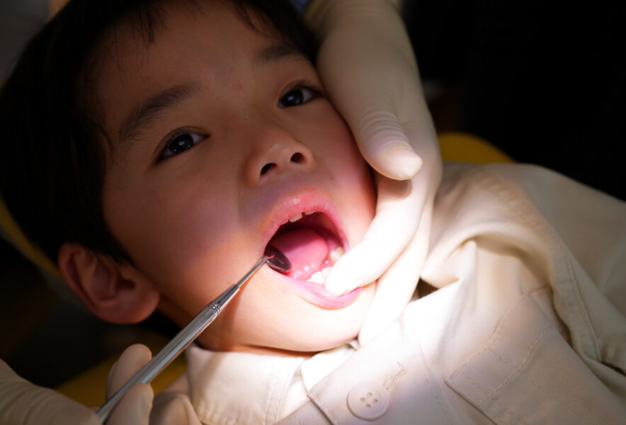 反対咬合（受け口）は 遺伝するって本当？原因や治療方法、予防方法を解説