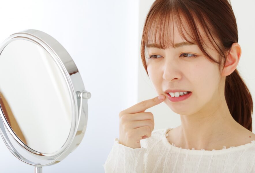 歯列矯正でブラックトライアングルができる原因は？治療法や予防方法も解説