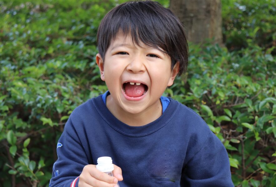 子どものすきっ歯は小児矯正で治療できる？治療を始める年齢の目安や治療の流れを解説