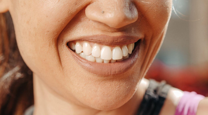 大人の歯科矯正の期間はどれくらい？