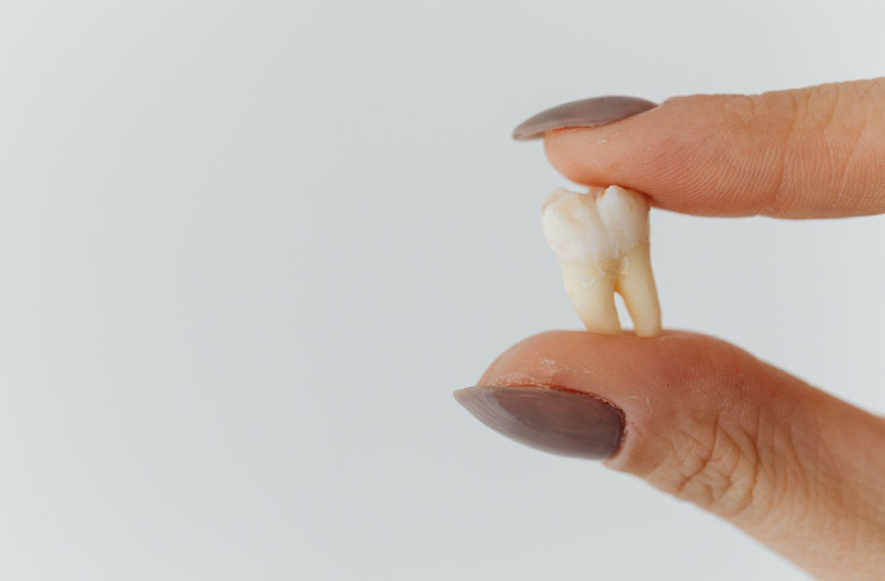 歯科矯正中の通院頻度