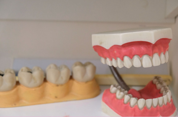歯列矯正の方法別メリット・デメリット