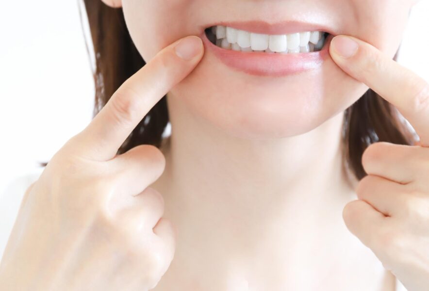 親知らずが歯並びを乱す？与える影響や抜歯が必要か見分けるポイントを紹介！