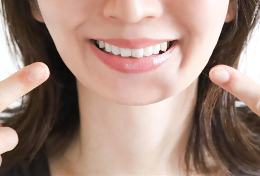 歯列矯正で顔の輪郭が変わる？理由や変わりやすい人の特徴を解説！