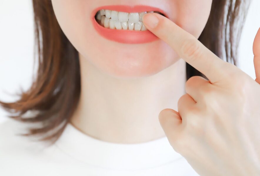 歯列矯正は痛い？痛みの種類や対処方法とともに解説！