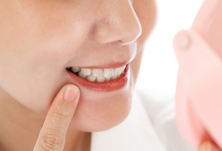 正しい歯並びとは？正しい歯並びの基準や歯並びを正しくする方法を解説！