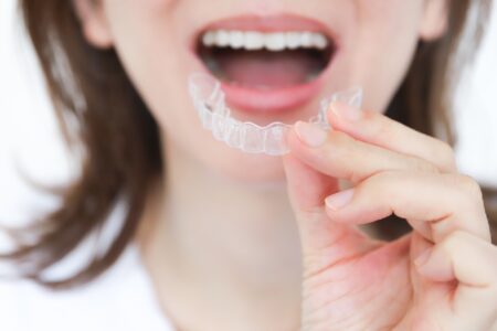 歯並びを矯正するマウスピース型矯正とは？メリット・デメリットや治療方法を解説！
