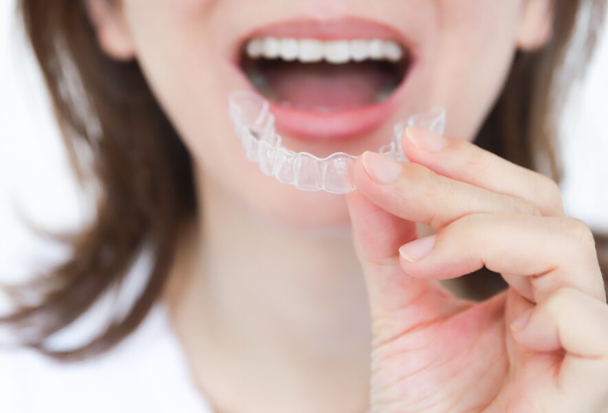 歯並びを矯正するマウスピース型矯正とは？メリット・デメリットや治療方法を解説！