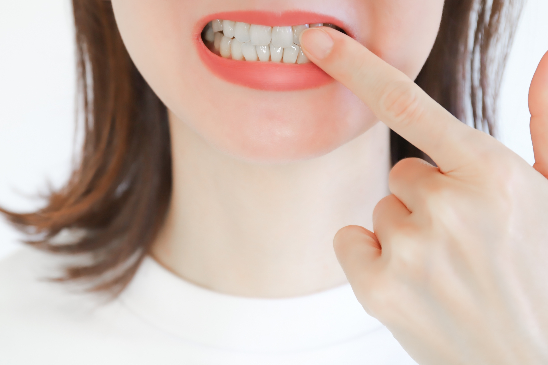インビザライン以外での出っ歯の矯正治療の選択肢