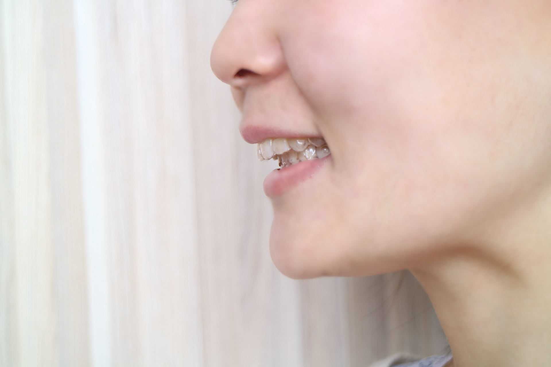 出っ歯による横顔への影響
