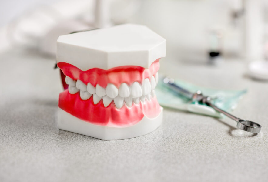 奥歯が当たらない？奥歯が噛み合わない理由と歯列矯正方法について解説