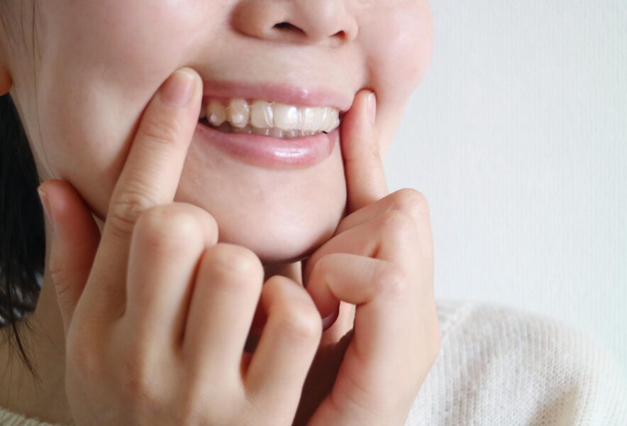 出っ歯を治す方法は？治療の種類や流れ、注意点まで詳しく解説