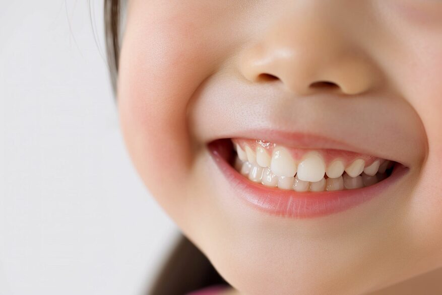 子どものすきっ歯が気になる！永久歯が生える前に治療すべき？