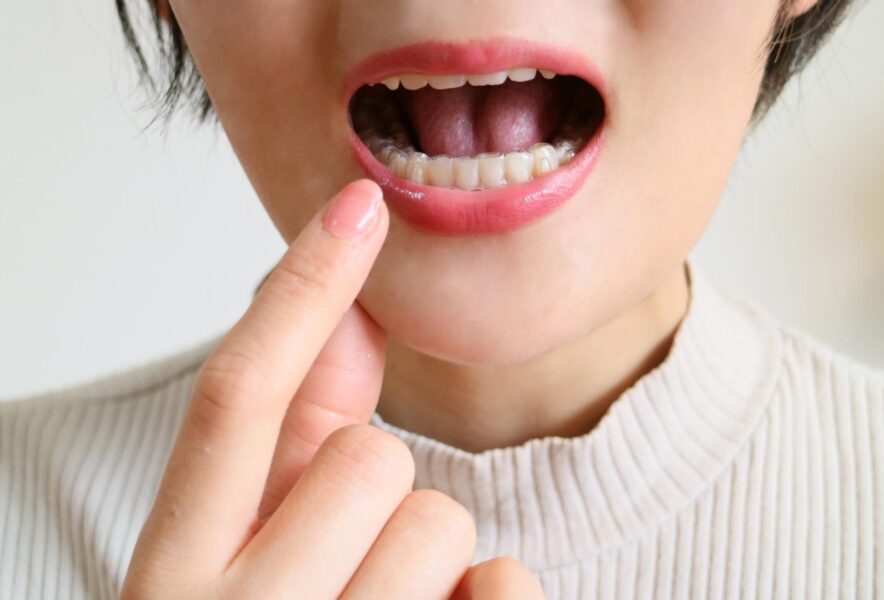 噛み合わせが原因で歯が痛い？噛み合わせが引き起こす症状や治療方法について解説！
