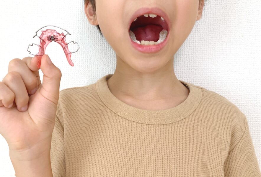 小児矯正はいつまでに行うべき？歯列矯正のメリットやデメリット、注意点を解説