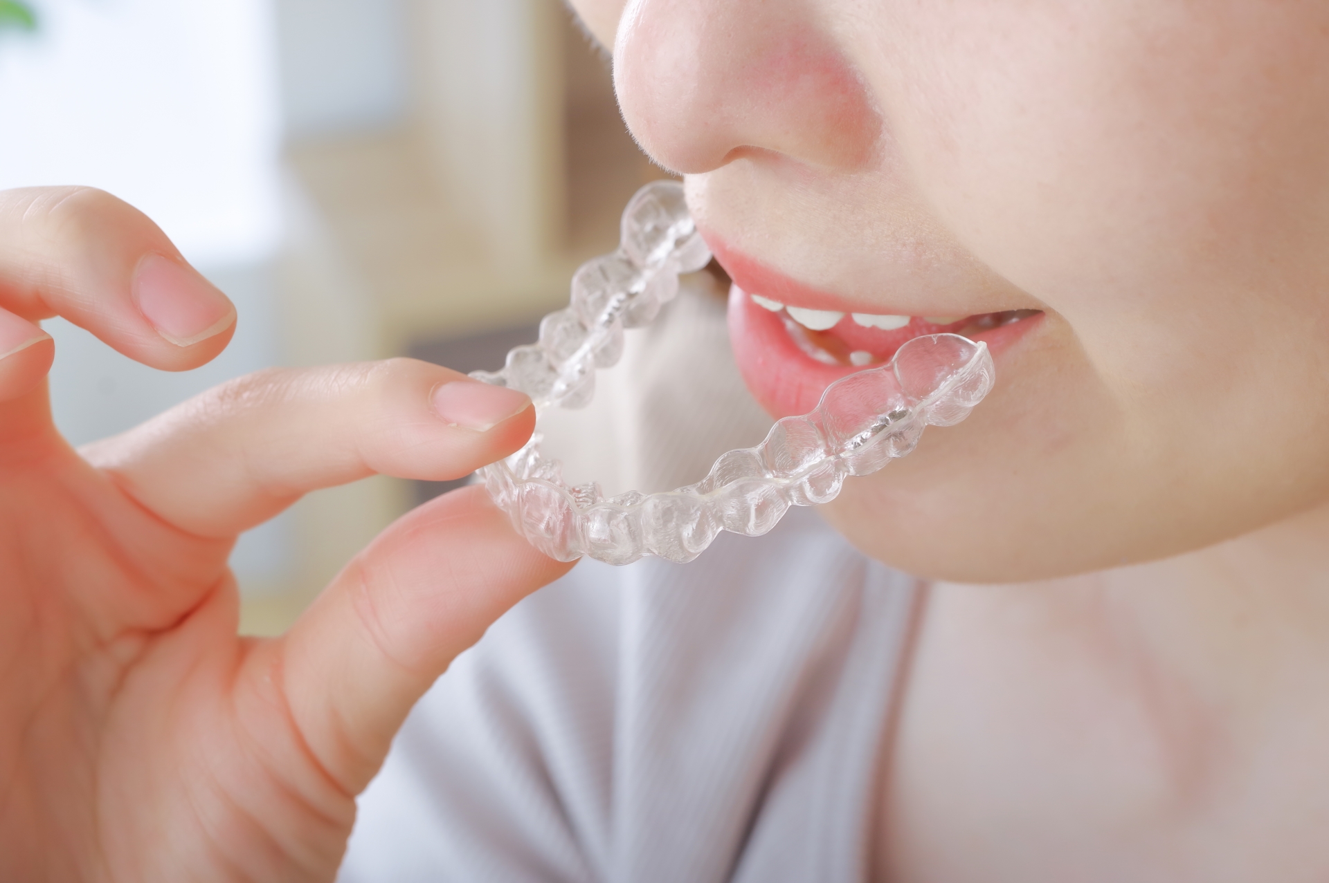 歯列矯正の基礎知識